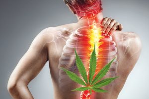 Medical-Cannabis-as-a-Back-Pain-Treatment-300x200.jpg