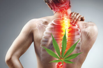 Is Weed a Remedy for Back Pain?