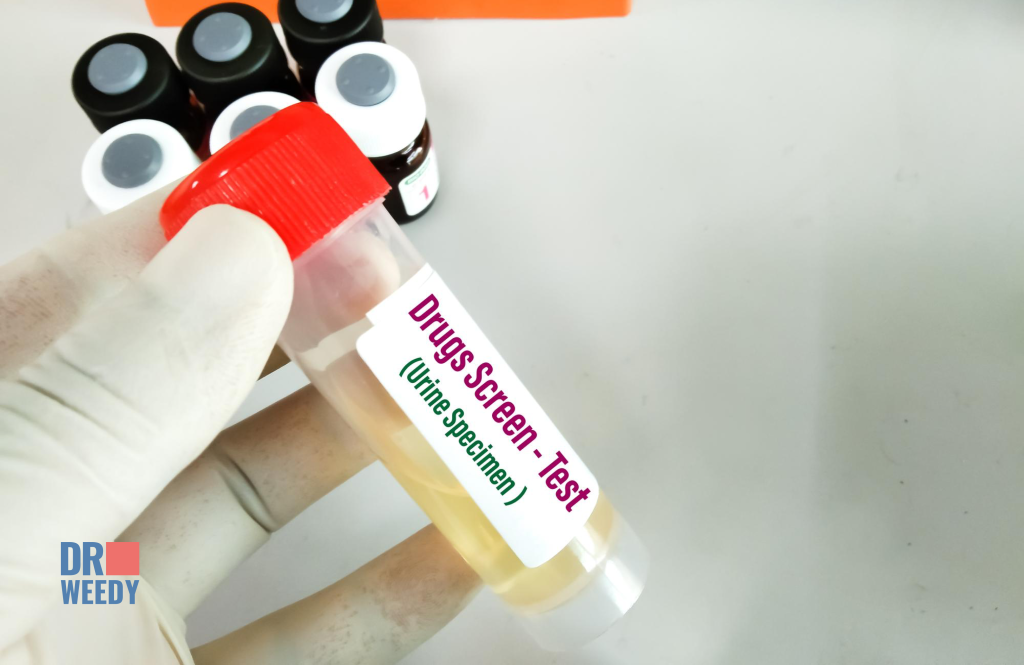 Urine testing